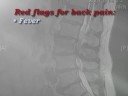 Back Pain Tips
