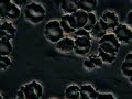 Cell Wall Deficient bacteria