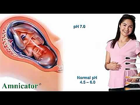 how to test for amniotic fluid leak