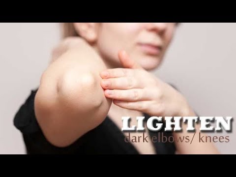 how to whiten dark elbows