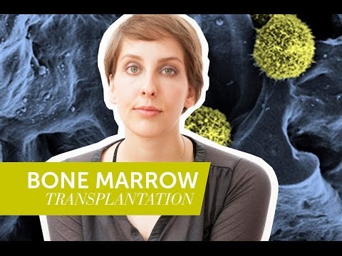 how to donate stem cells for transplant