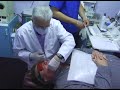 Orthodontic Jaw Wiring for Weight Loss - Part One Orthodontic Jaw Wiring for Weight Loss - Part One