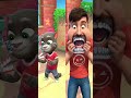 My Talking Tom vs Mr Beast || Mr Beast Wear Diamond Teeth