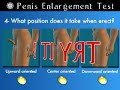 penis enlargement treatments