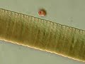 Dinoflagellate dances over Cyanobacteria
