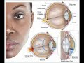 Glaucoma And The Myth of Medical Marijuana / Anti-Marijuana Video