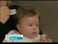 Asombrosa delicadeza de la piel de los niños bebes chicos Asombrosa delicadeza de la piel de los niños bebes chicos