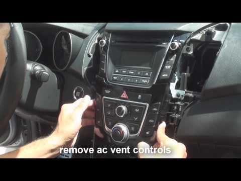how to remove ix35 radio