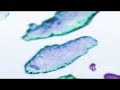 Macrophages engulfing pathogens (Hybrid Medical Animation) Macrophages engulfing pathogens (Hybrid Medical Animation)