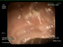 ERCP (Dr. Cisneros/Dr. Coghlan)