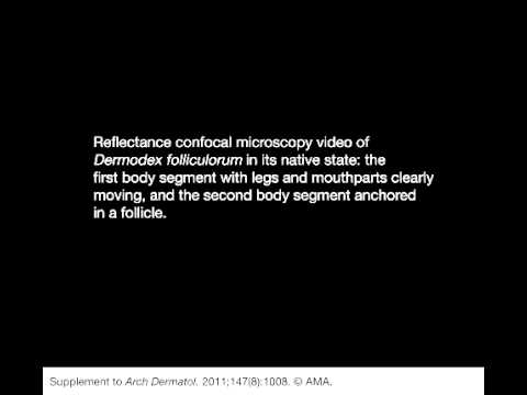 how to treat d. folliculorum