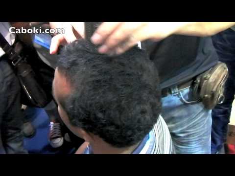 how to cover a bald patch on your head