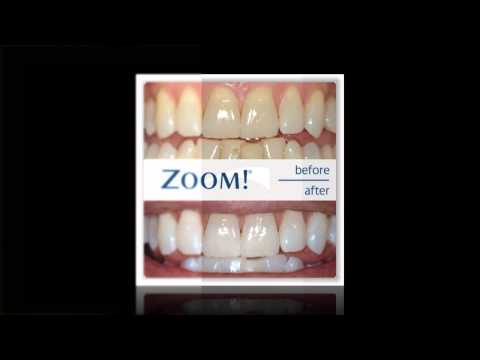 how to whiten your teeth with zoom