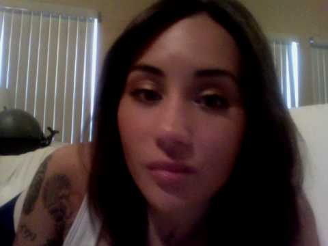 Acne treatment Levulan: Day 7
