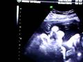 videos de MY LAST SONOGRAM