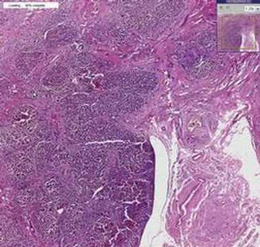 Histopathology Liver--Primary ...