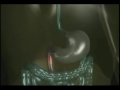 Click here to watch this video La mejor forma que conozco para lograr una absorcion. La micelizacion.mp4