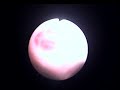 Sea Turtle Bronchoscopy II