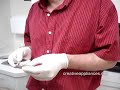 Simple Chairside Fix To Loose Finger Spring Simple Chairside Fix To Loose Finger Spring