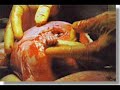 El aborto no es solución para la delincuencia El aborto no es solución para la delincuencia