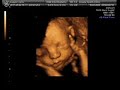 Baby 4D scan Baby 4D scan