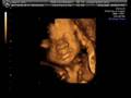 Baby 4D scan