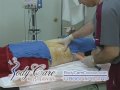 Liposculpture procedure. smartlipo is...