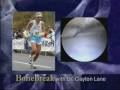Meniscus Tears