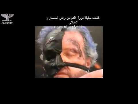 كشف حقيقة ظهور الدم في المصارعه