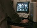 vdj4 - bcd2000