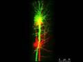 videos de Double labeled neurons of brain slices
