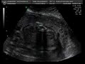 Ruthchelle Quearney 3d scan