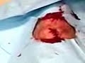 Axe-hole in my leg - Take 4
