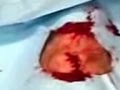 videos de Axe-hole in my leg - Take 4