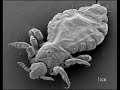 Magnified Images