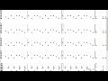 dream theater   the glass prison tab