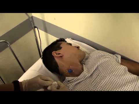 how to remove central line