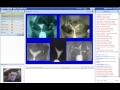 Tekrarlayan Gebelik Kayıpları Webinar Prof Dr Bülent Urman www.bulenturman.com