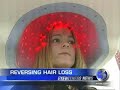 Laser Hair Rejuvenation 2