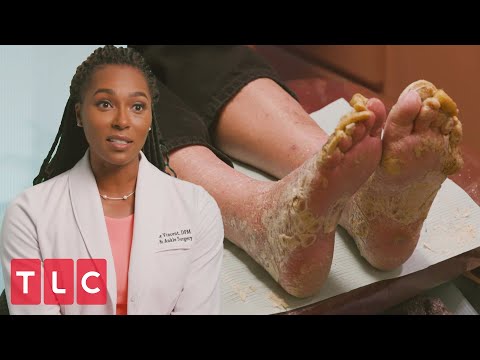 Sneak Peek: My Feet Are Killing Me