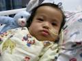 nathan 6 days post craniotomy