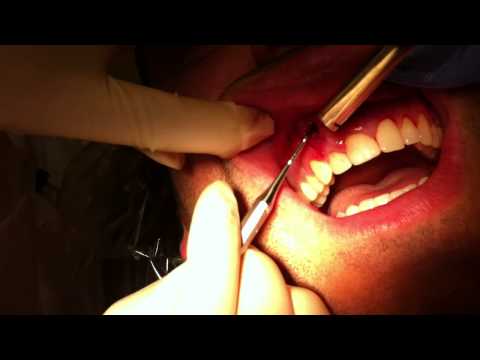 how to help inflamed gums