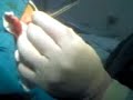 Operacion Quiste