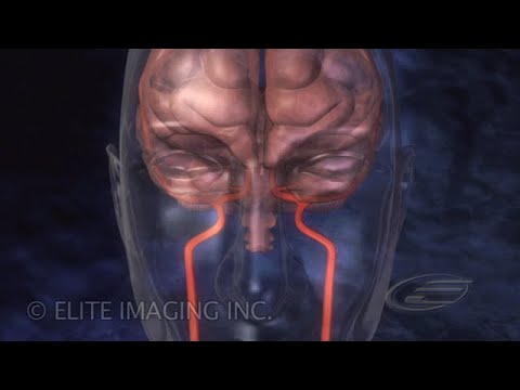 how to dissolve clots