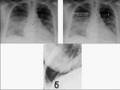 Medical School Pathology, Chapter 4c