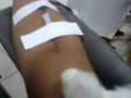 Doe sangue!