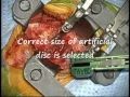 Live Video of Cervical Disc Replacement by Hussien El-Maghraby