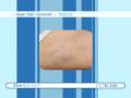 videos de Laser Hair Removal Los Angeles