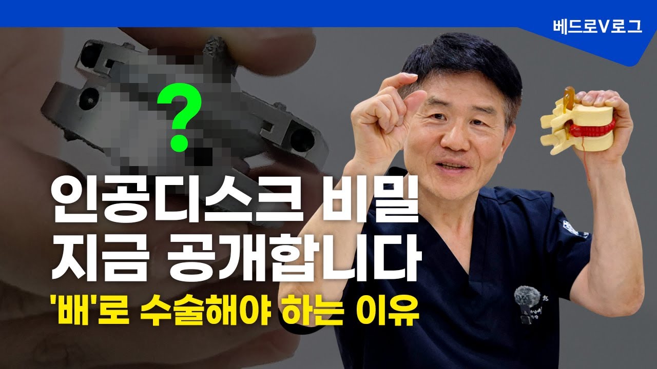 내 몸에 들어가는 인공디스크, 한번 보실래요?