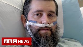 מתנגדי חיסונים בארה”ב מתחילים לשנות את דעתם לאחר שאושפזו בבתי חולים במצב קשה